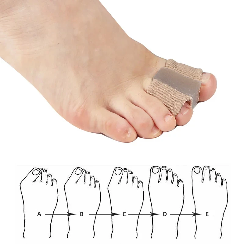 Toe Separator Silicon - 1 個シリコーンつま先スプレッダー指セパレーター外反母趾矯正装置親指矯正ストレートナー足ケア整形外科