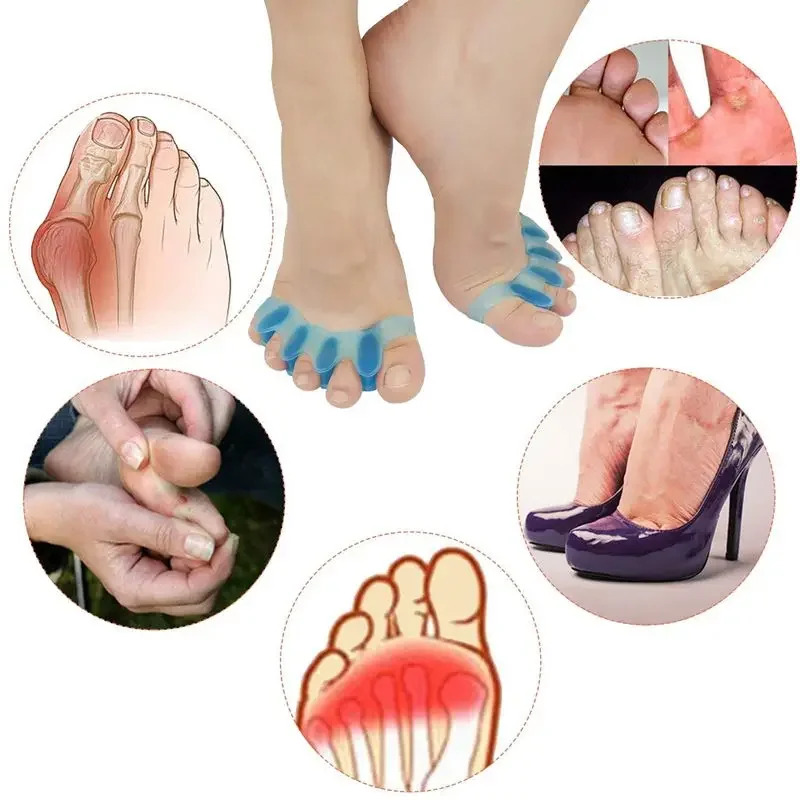 2 個 = 1 ペア新しい保護つま先セパレーター適切な外反母 - Toe Separator Silicon のレビューと価格