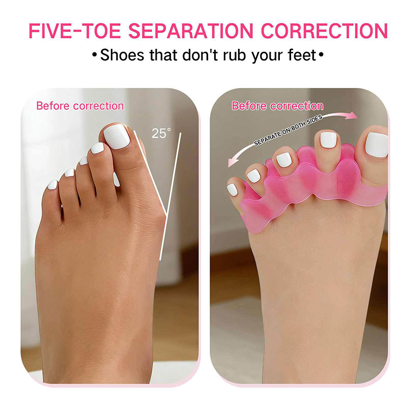 1ペアのシリコン製つま先セパレーター、足底筋膜炎、外反母趾の - Toe Separator Silicon のレビューと価格